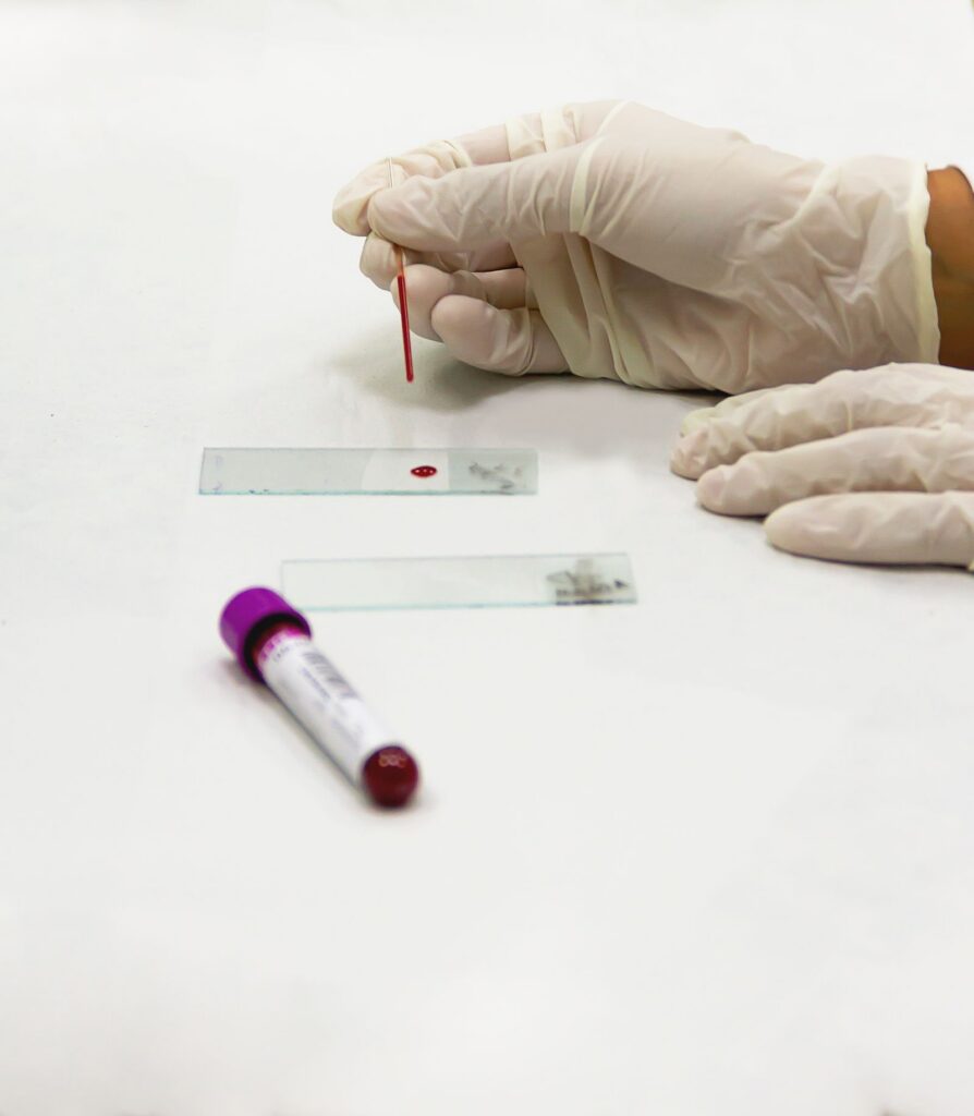 A laboratory technician preparing a canine blood sample, since handling is one reason progesterone results differ between labs